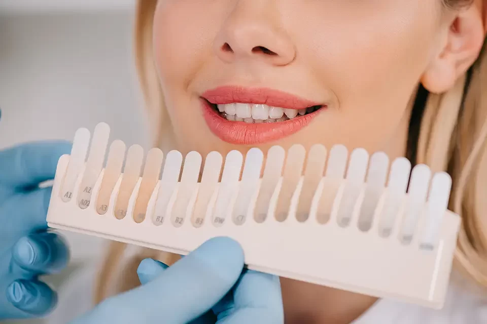 Tips for Maintaining Whiter Dental Crowns