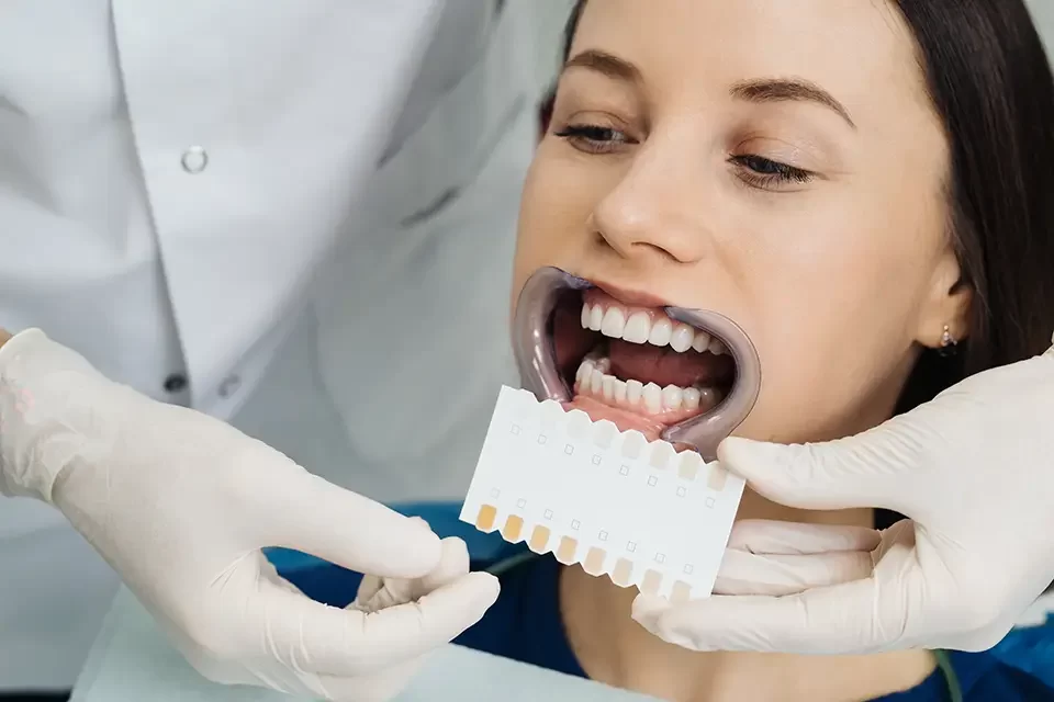 Veneers or Crowns
