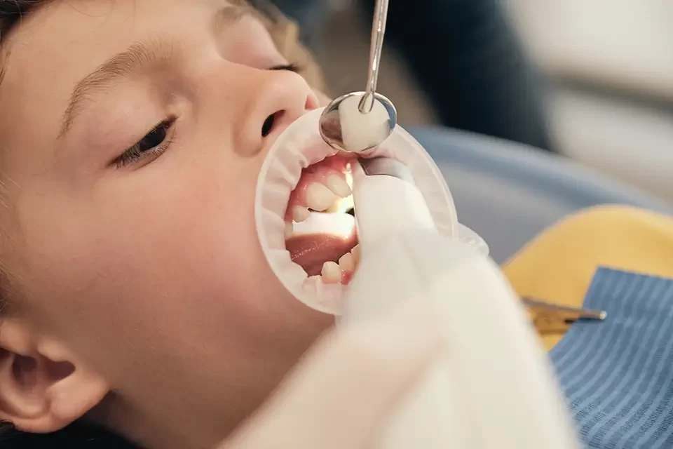 What Are Dental Fillings for Children?