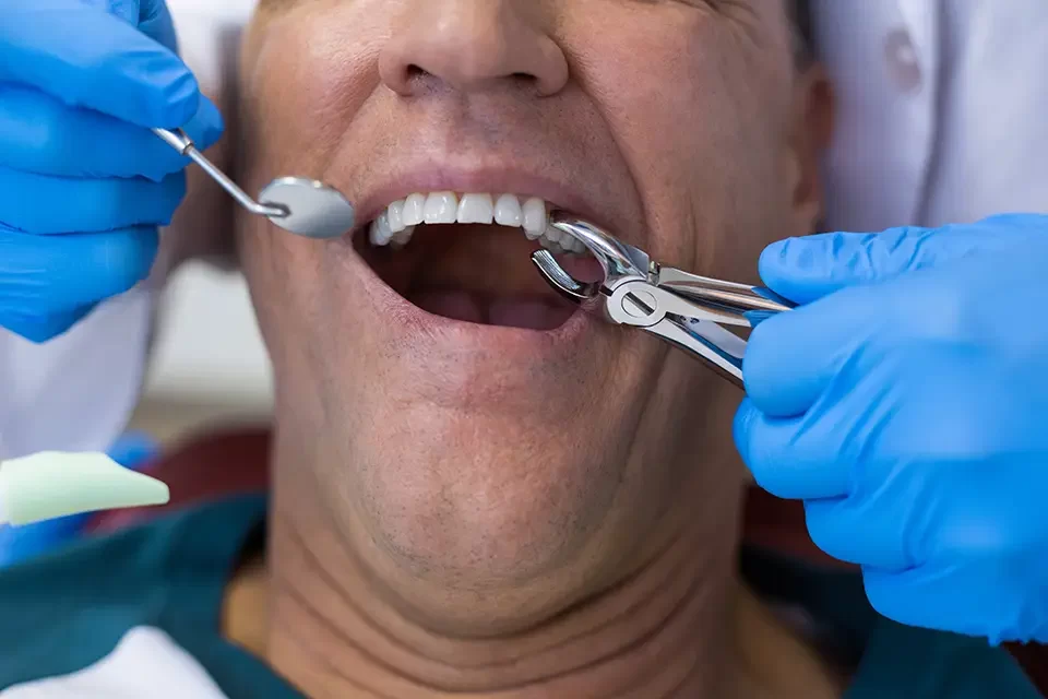 1. Neglecting Proper Rest – Common Mistakes After Dental Extraction