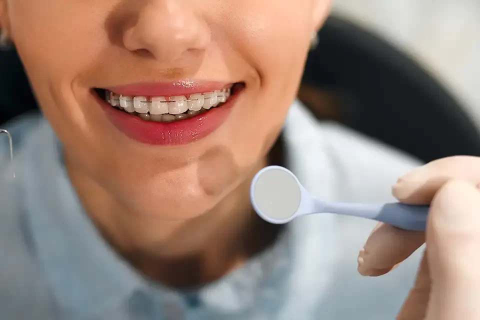 dentistry Typical Duration for Different Types of Orthodontic Treatments