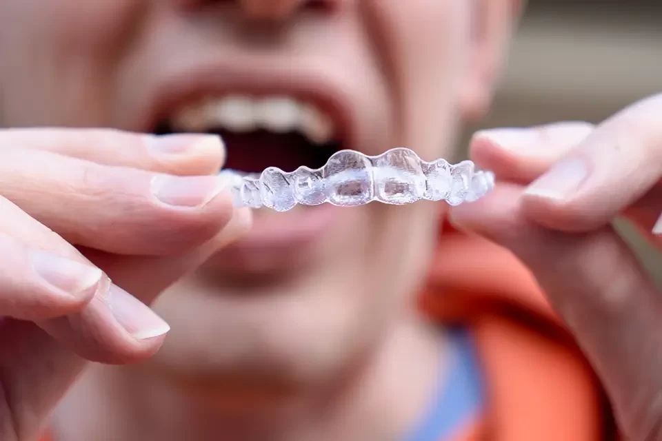 Invisalign for Teens vs Adults: A Tailored Path to a Straighter Smile for Every Age
