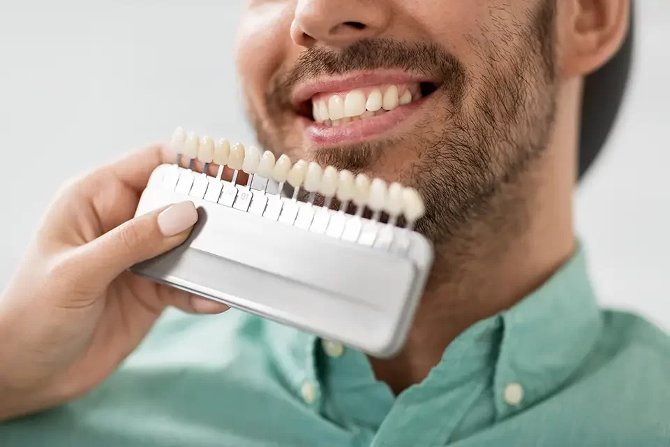 Do Dental Veneers Actually Transform Your Smile?