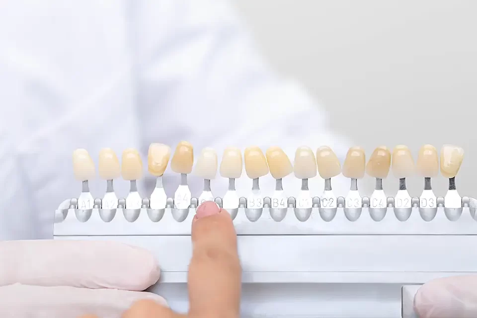 palette-with-shades-of-teeth-dental-samples 5 Common Types of Dental Crown Materials
