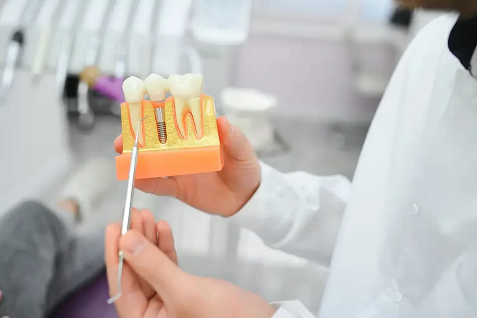 Discover the Top Benefits of Dental Implants for a Healthier Smile