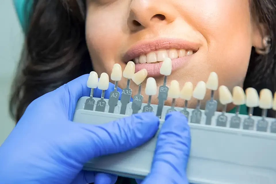 Key Differences Between Porcelain vs. Ceramic Dental Crowns