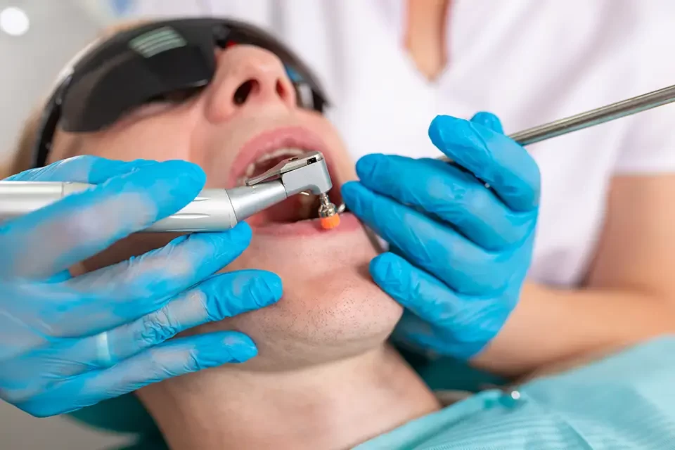 treatment-of-caries-a-dentist-treats-the-patient Composite vs. Amalgam Fillings: Factors to Consider When Choosing Fillings