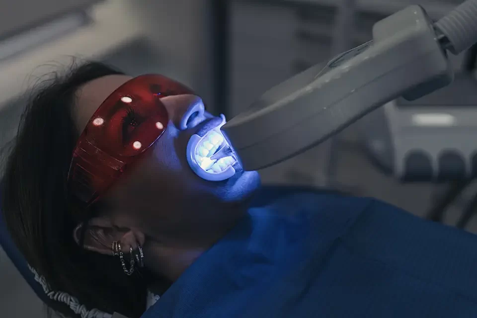 Zoom Teeth Whitening Toronto: The Step-by-Step Process